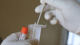 UK PCR tests ‘double cost of European tests’