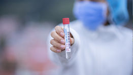 Test to release scheme 'falling apart' as providers withdraw