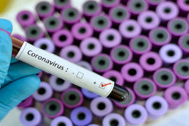 coronavirus-blood-draw-gettyimages-1201863584