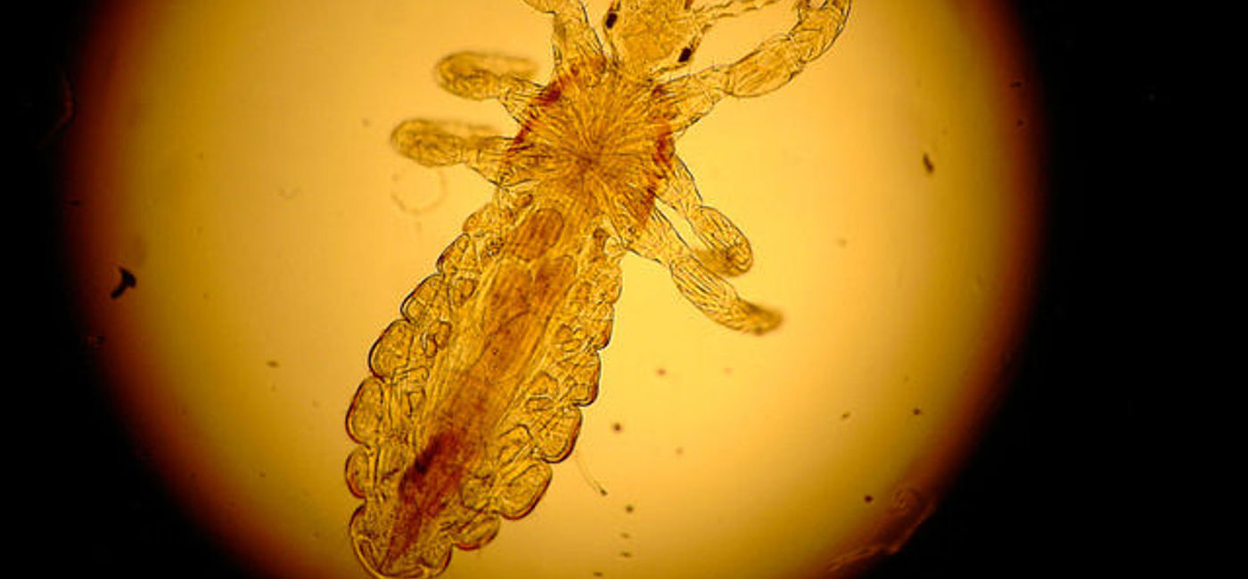 Image: PHOTO: Lice up close. (photo via Flickr/Michael Wunderli)