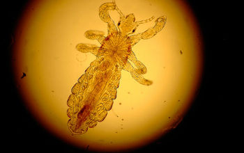 Lice up close