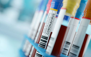 COVID-19 Coronavirus test tubes.