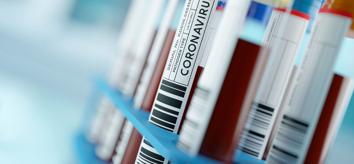 Image: Coronavirus test tubes. (iStock/Getty Images Plus/solarseven)