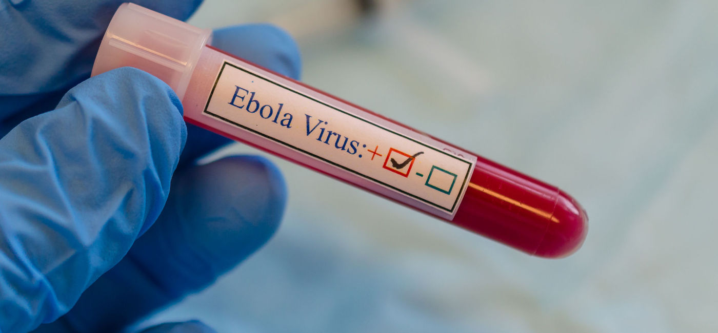 Image: PHOTO: Ebola virus positive blood. (photo via Manjurul / iStock / Getty Images Plus)