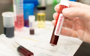Close-up of blood in a test tube amid the coronavirus outbreak