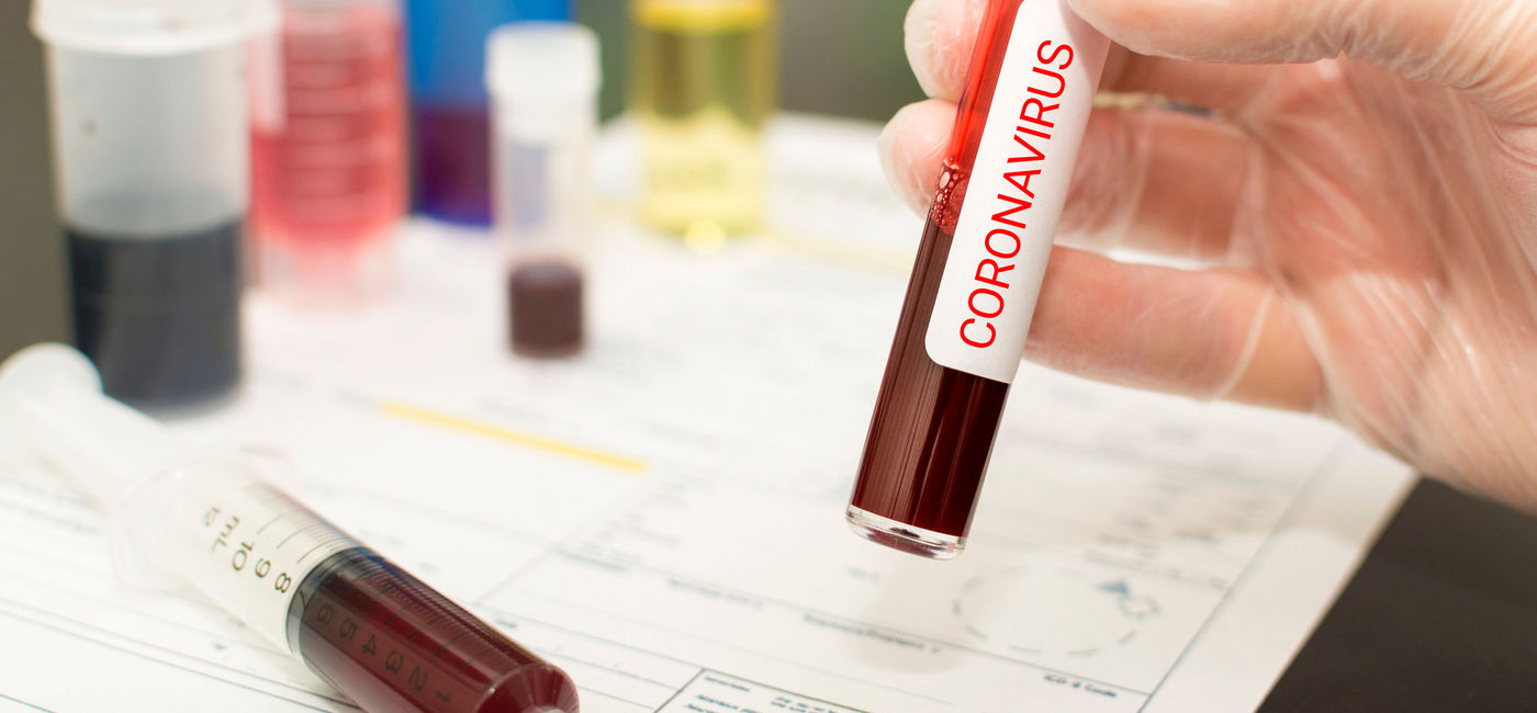 Image: PHOTO: Close-up of blood in a test tube amid the coronavirus outbreak. (photo via mrtom-uk/iStock/Getty Images Plus)