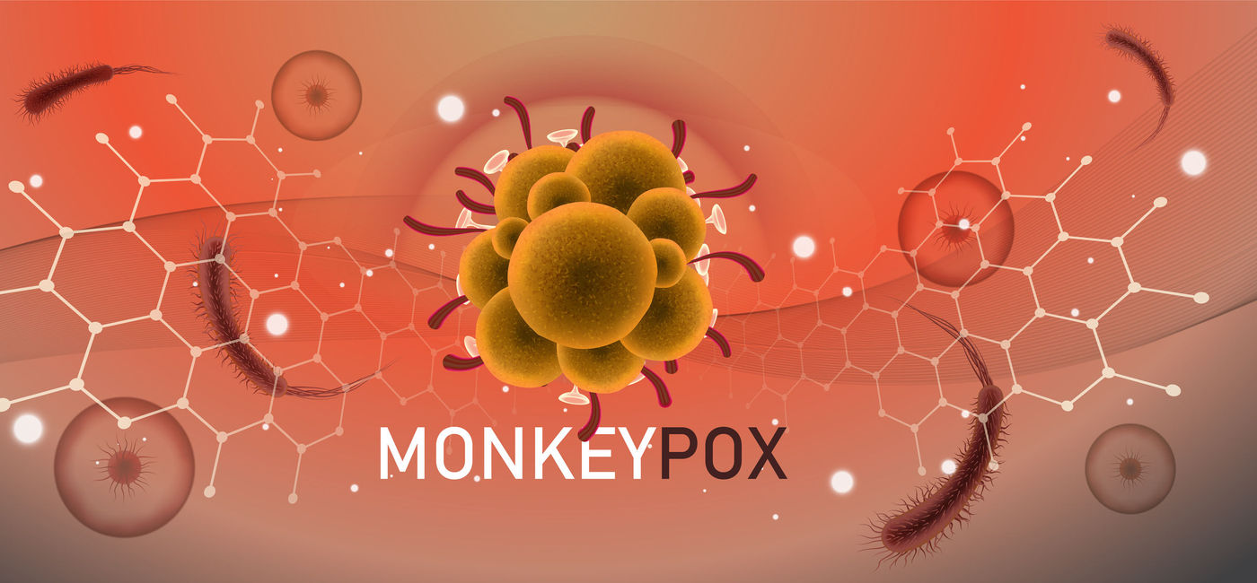 Image: The World Health Organization has declared monkeypox a public emergency. (ZEEDIGN / iStock / Getty Images Plus)