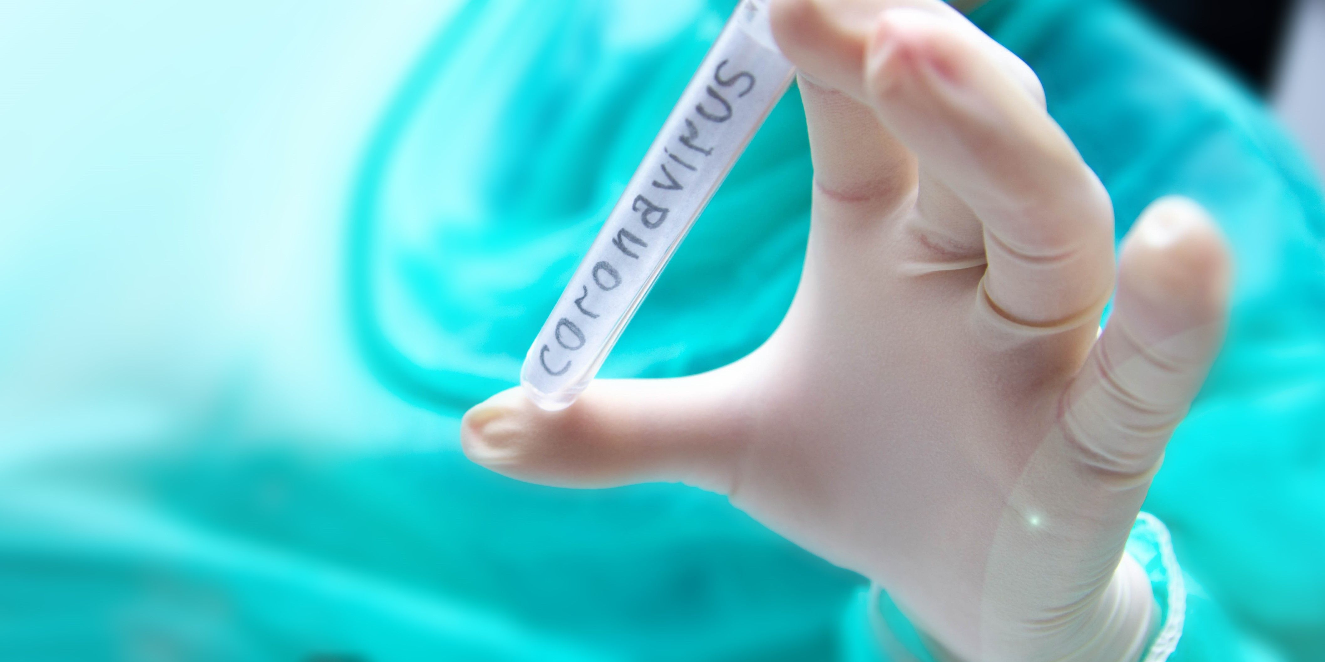  alt="coronavirus-hotel-airline-revenue-management"  title="coronavirus-hotel-airline-revenue-management" 