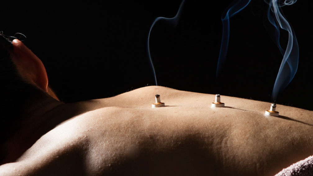 In this traditional Chinese therapy, dried mugwort is burned and then applied to the skin. // © 2016 iStock 2