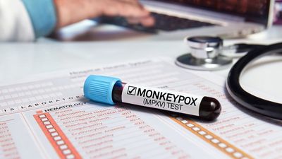 Mpox, previously known as monkeypox, spreads through close contact and contaminated materials, causing symptoms like fever, rash, and swollen lymph nodes.