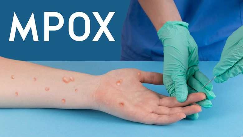 The World Health Organisation has declared recent outbreaks of Mpox as an international public health emergency.
