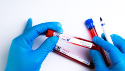 Malaysia reported nine mpox cases in 2023.