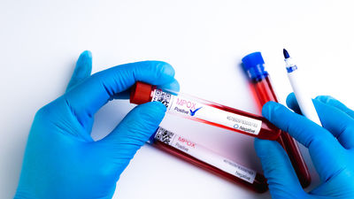Malaysia reported nine mpox cases in 2023.