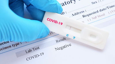 The CDC will reportedly require all people who plan to enter the U.S. on commercial airline flights to show proof of a negative Covid-19 test prior to boarding.