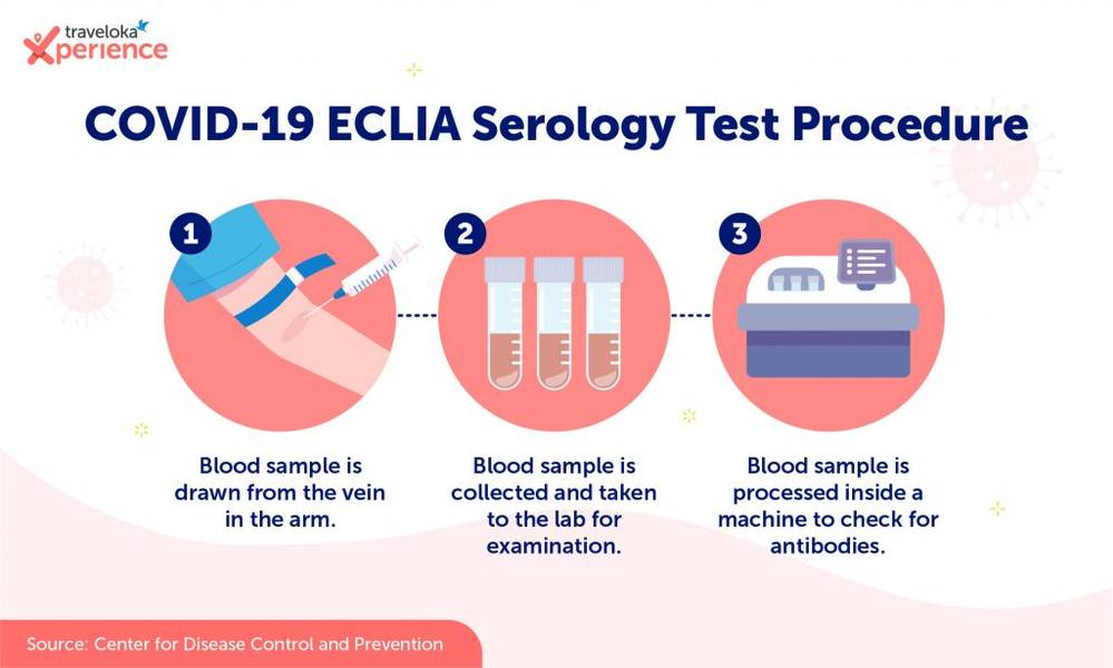 ECLIA Test EN version