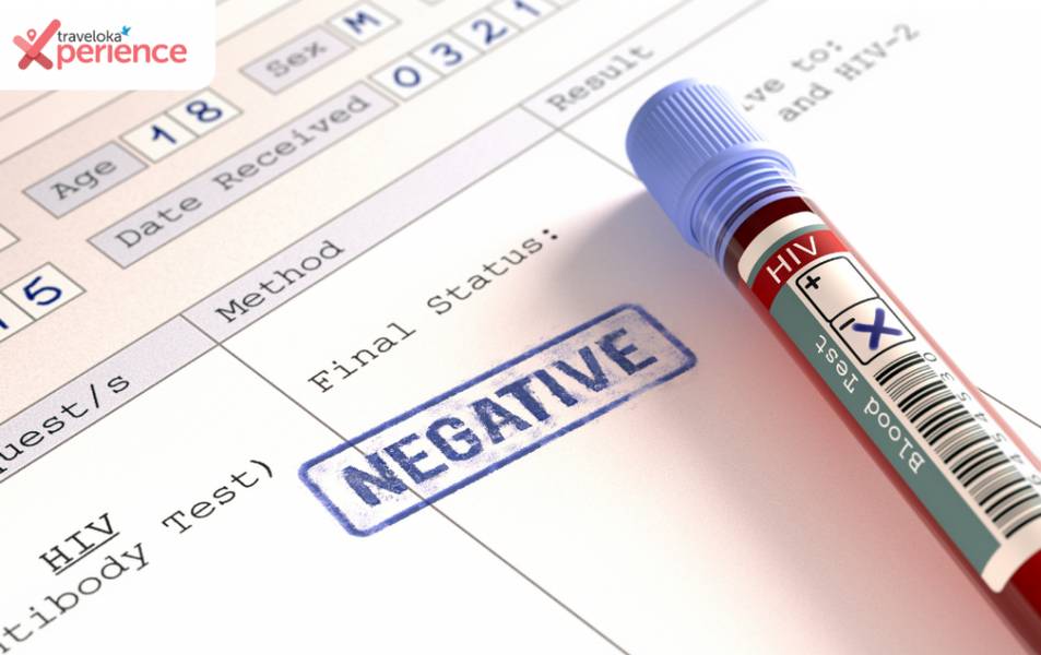 check antibody whether it positive or negative